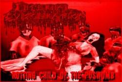 Rotting Child of the Puswomb